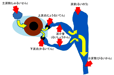 涙点閉鎖治療について