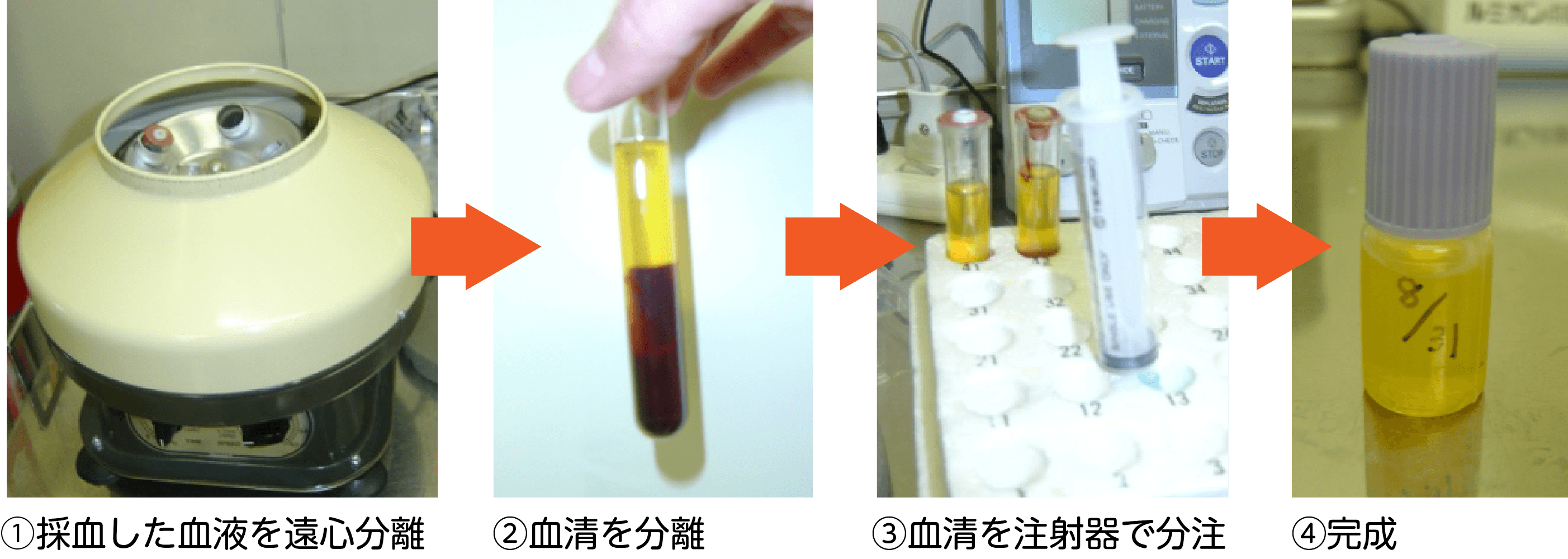 血清点眼療法について