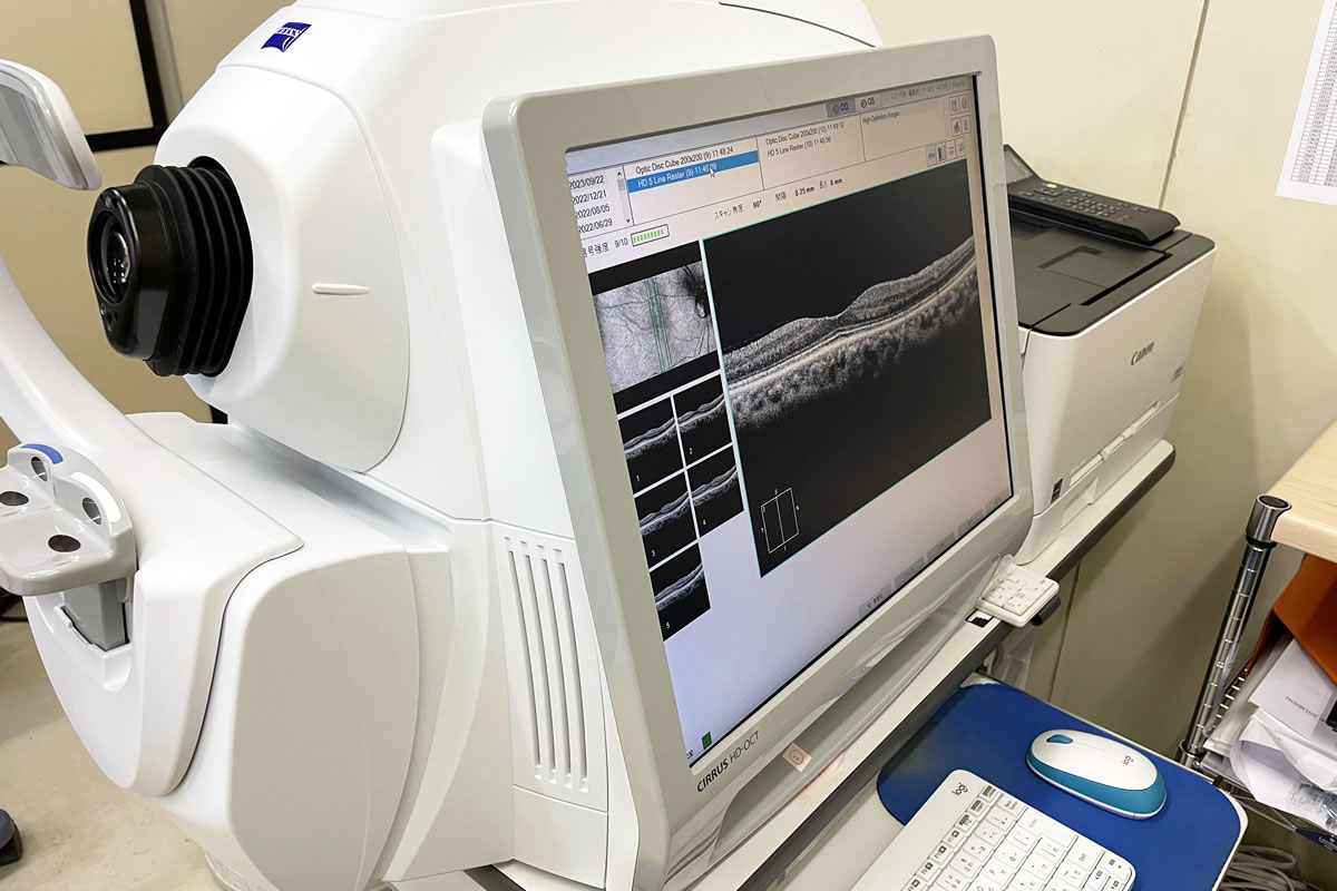 ＯＣＴ（Optical Coherence Tomography: 光干渉断層計）